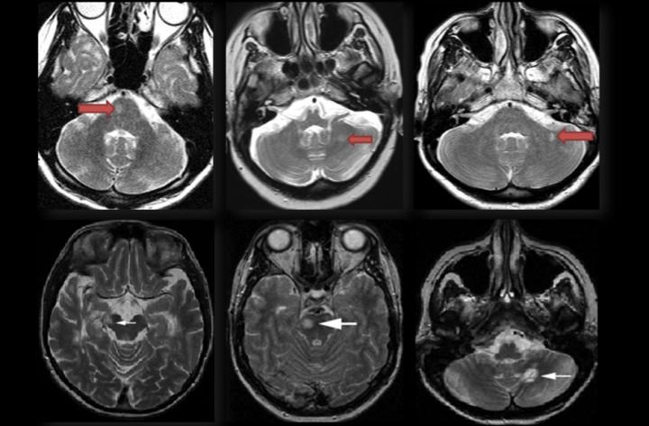 MRG-5: Kirli ak madde görünümü