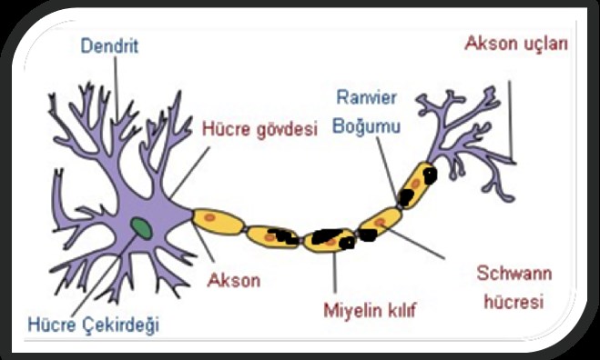 Miyelin kılıf üzerinde hasarlı alanlar gösterilen nöron görseli